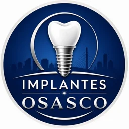 Implantes Osasco - SP